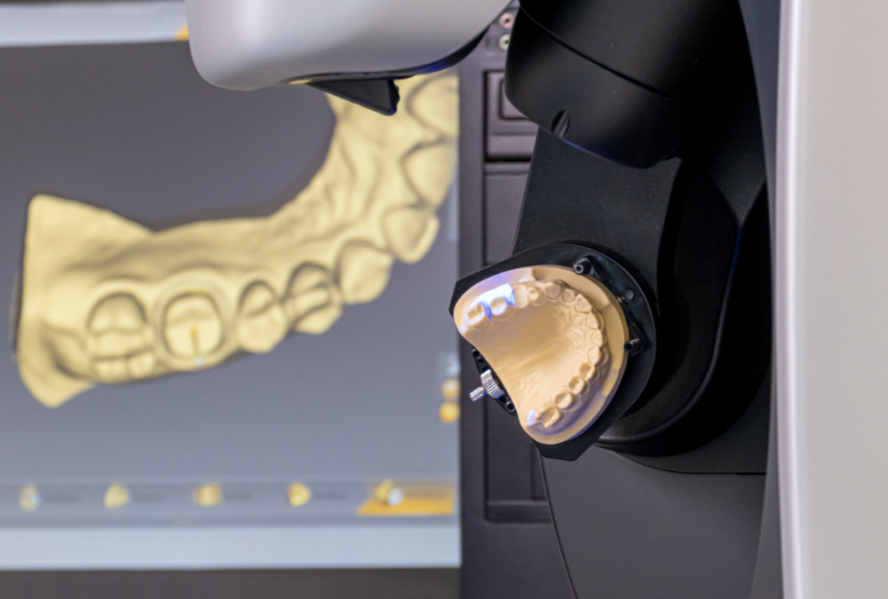 What Is CAD/CAM Technology in Dentistry | Royal Dental